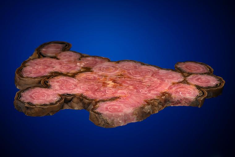 RHODOCHROSITE
