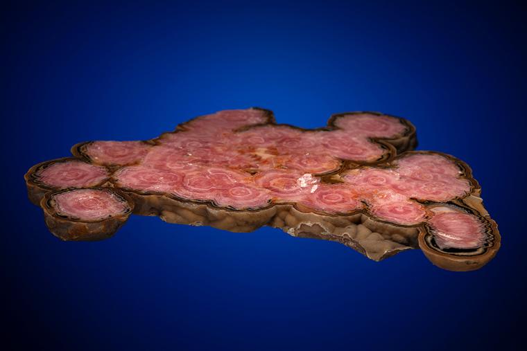 RHODOCHROSITE