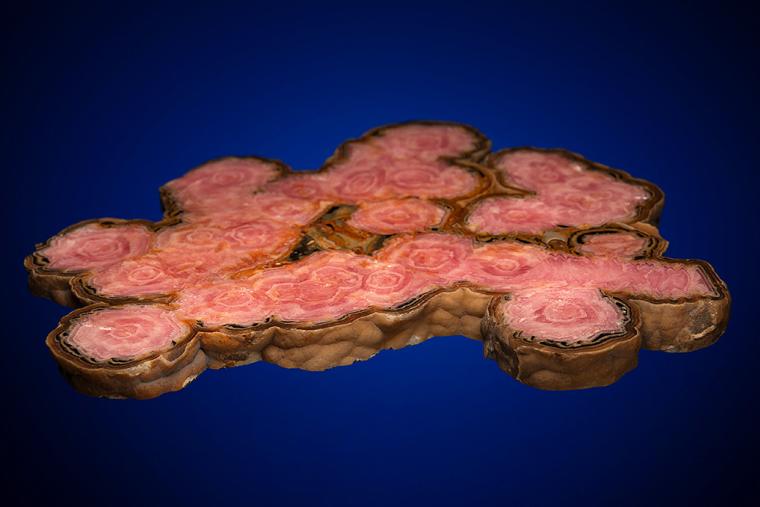 RHODOCHROSITE