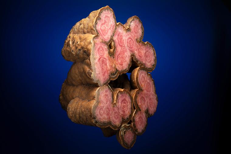 RHODOCHROSITE