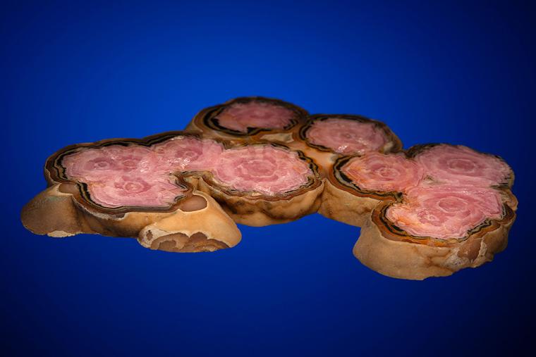 RHODOCHROSITE